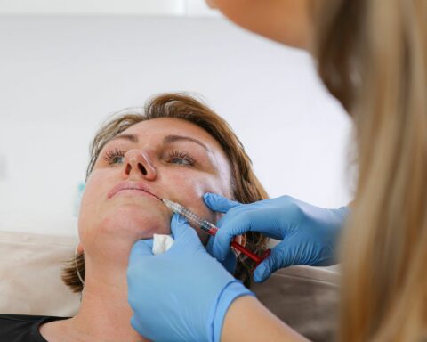 How to Prepare for Your First Lip Filler Appointment