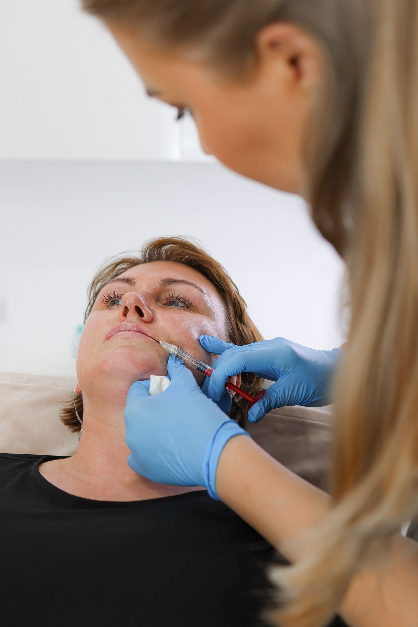 Lip Filler London – Lip Augmentation in London & Natural Lip Enhancement